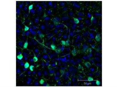 Immunohistochemical Detection of GFP in Free Floating Mouse Brain